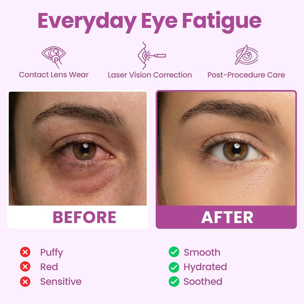 Eye Serenity Self-Heating Steam Mask Variety Pack